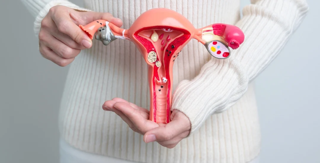 Understanding the Complex Symptoms of Endometriosis